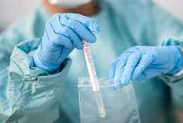 વિદેશથી આવતા મુસાફરોના   RT-PCR  નહીં થતા હોવાની ફરિયાદો