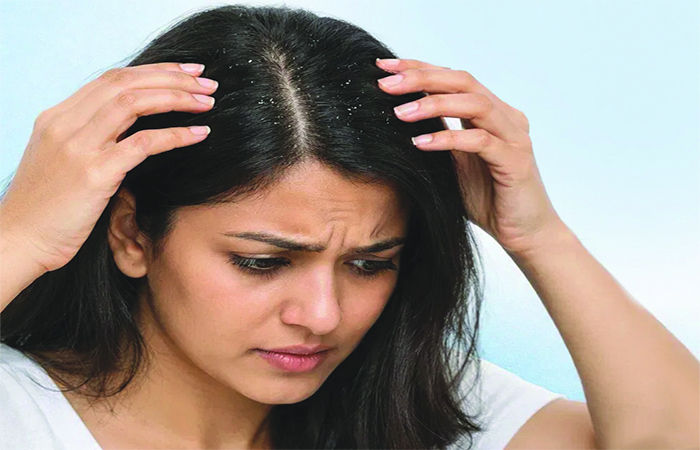 સૌંદર્ય સમસ્યા                                                                    .