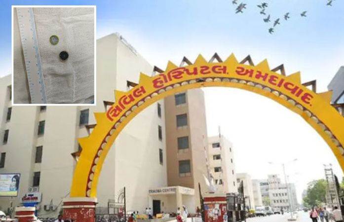 વાલીઓ માટે ચેતવણીરૂપ કિસ્સો: રમતમાં બટન સેલ ગળી ગયો 5 મહિનાનું બાળક, સિવિલના ડૉક્ટરોએ જીવ બચાવ્યો