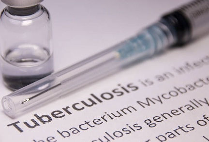Gujarat reports 19,000 cases of TB in children in last three years