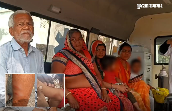 અમરેલીના મોટા લીલીયા ગામે શ્વાનોનો આતંક, 6 લોકો અને 8 પશુઓને બચકા ભર્યા