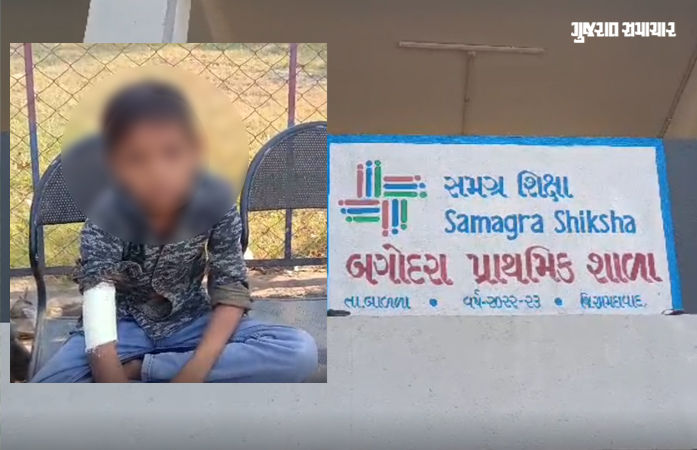 અમદાવાદ: આ કેવું ભણતર! બગોદરા પ્રાથમિક શાળાની શિક્ષિકા ભાન ભૂલ્યા, વિદ્યાર્થીને લાકડીથી ફટકારતાં ફરિયાદ દાખલ