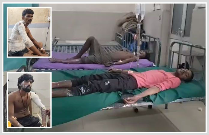 હાલોલ GIDCમાં એગ્રો કંપનીમાં ગંભીર દુર્ઘટના, ગરમ પાણીનો વાલ્વ ખૂલી જતાં 5 શ્રમિકો દાઝ્યા
