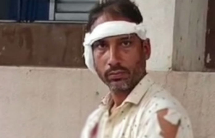 નવસારી: ભત્રીજાએ કાકાનો કાન બચકું ભરી છૂટો પાડ્યો, સર્જરી કરી જોડ્યો, આરોપીની ધરપકડ