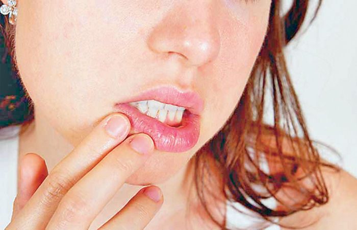 Why Do Lips Get Chapped?