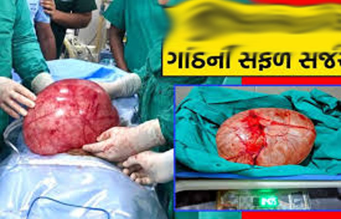 ભાવનગરની મહિલાના પેટમાંથી સર્જરી કરી 8 કિલોની ગાંઠ કાઢવામાં આવી