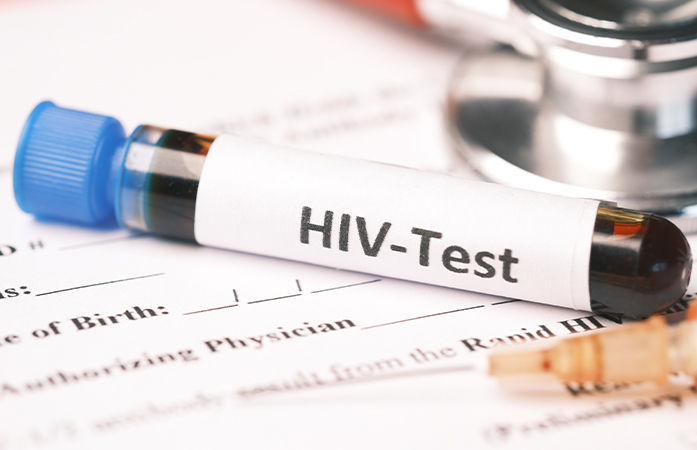 HIV ટેસ્ટ વગર નહીં થાય લગ્ન, ભારતની આ રાજ્યની સરકારનો મોટો નિર્ણય લેવાની તૈયારી