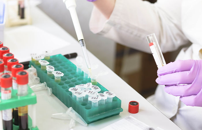 Chandipura Virus: First case reported in Ahmedabad, 22 positive cases in Gujarat