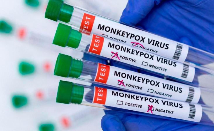 27 confirmed cases of Mpox, 1 death reported from India since 2022: WHO
