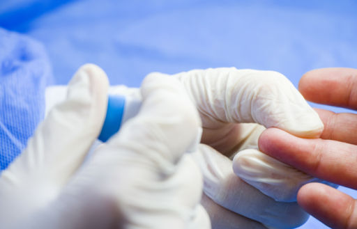 Alzheimer’s biomarker detection can now be done at home: Research
