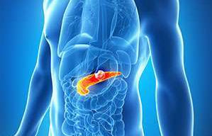 Two major breakthroughs offer new hope for pancreatic cancer patients