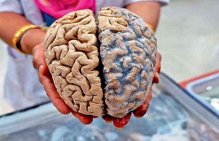 મગજ વિશે ઓછી જાણીતી અદ્દભૂત વાતો