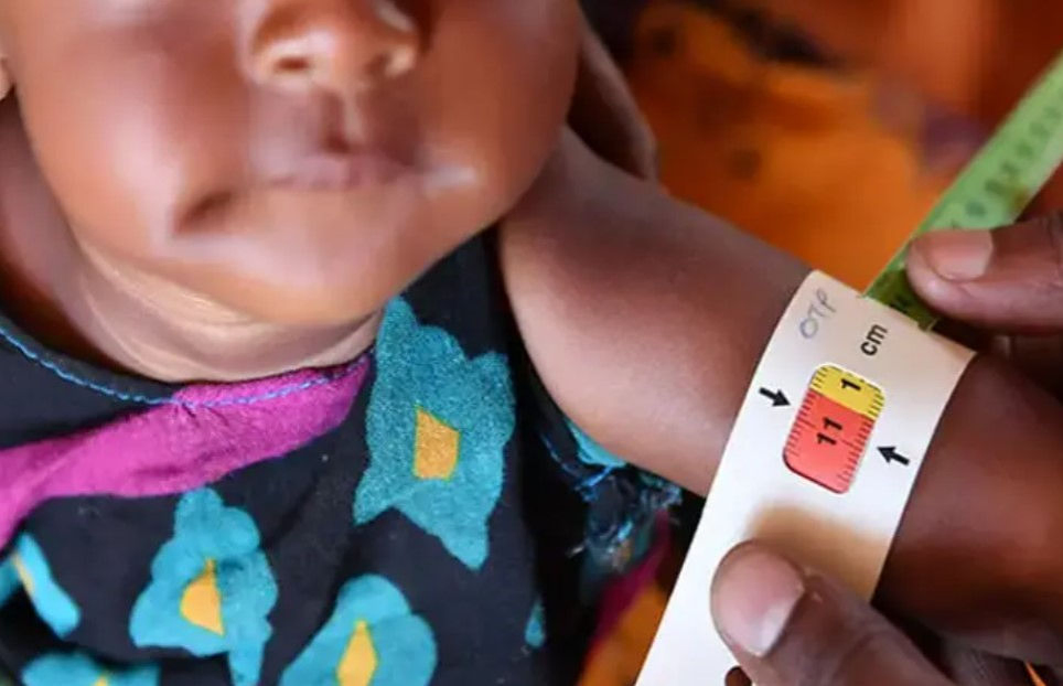 Malnutrition in Gujarat: 37% children stunted, 20% underweight