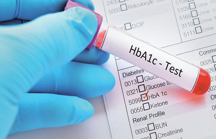 ભારતીયોમાં HbA1c બ્લડ ટેસ્ટના આધારે થતું ડાયાબિટિસનું નિદાન ભૂલભરેલું હોઈ શકે છે