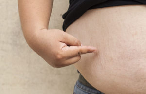 India’s high-carb diets driving surge in diabetes and obesity, study warns