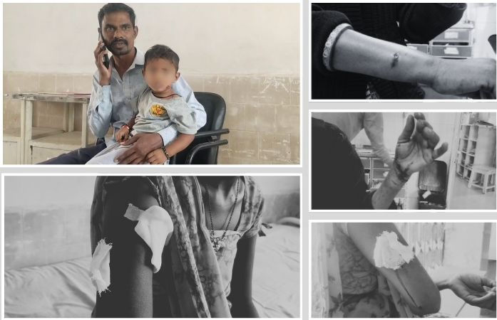 અમરેલીમાં હડકાયા શ્વાનનો આતંક: ખાંભાના ચકરાવા ગામે બાળકો અને મહિલાઓ સહિત 6 લોકોને બચકા ભર્યા