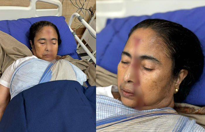 Mamata Banerjee suffers ‘major’ injury, rushed to hospital: TMC
