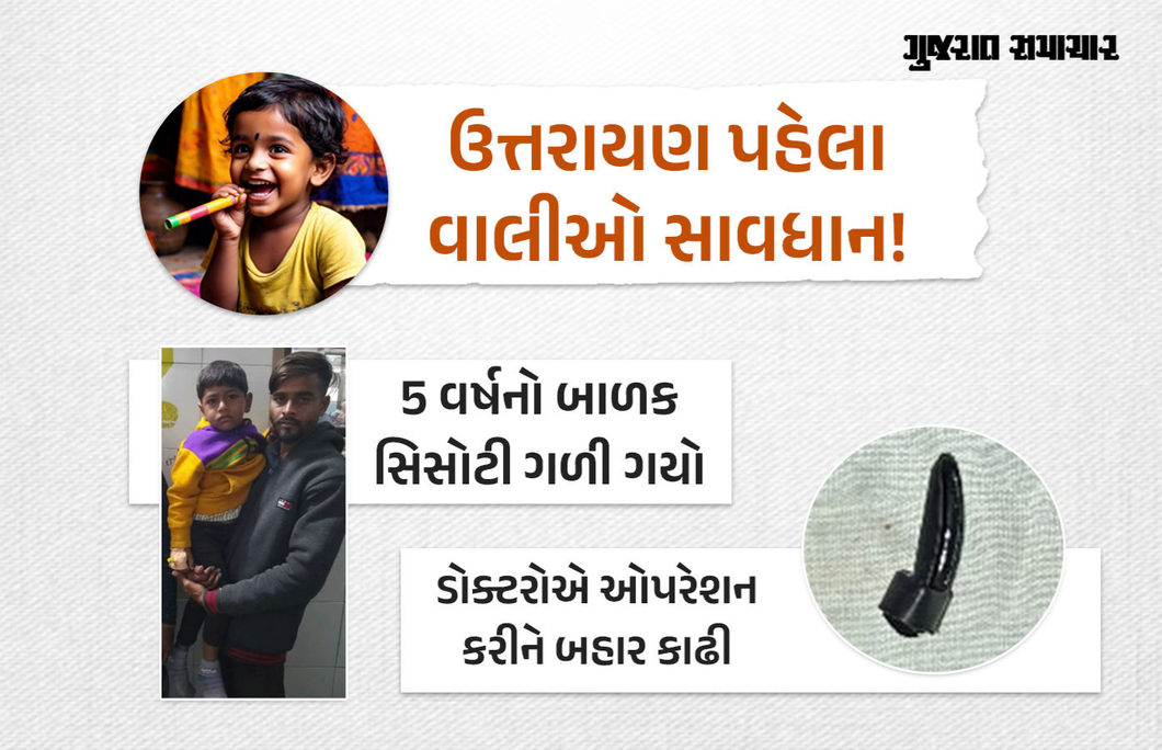 ચેતવણીરૂપ કિસ્સો: દાહોદમાં પાંચ વર્ષનું બાળક સિસોટી ગળી ગયું, ડૉક્ટરોએ સર્જરી કરીને બહાર કાઢી
