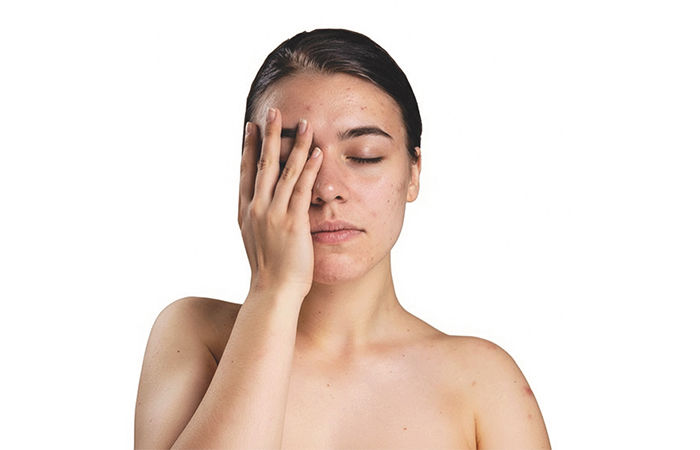 સૌંદર્ય સમસ્યા                                                                    .