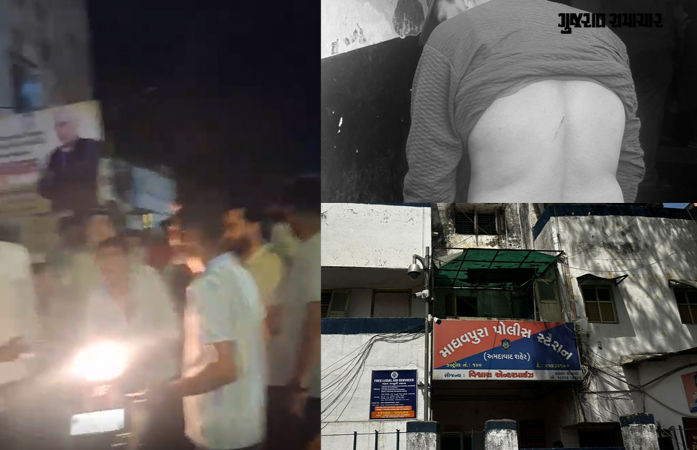 અમદાવાદ: દુધેશ્વર બ્રિજ પાસે નજીવી બાબતે જૂથ અથડામણ, પોલીસની હાજરીમાં બજરંગદળના કાર્યકર પર તીક્ષ્ણ હથિયારથી હુમલો