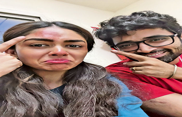 મૃણાલ ઠાકુર અને અદિવિ  શેષને શૂટિંગ વખતે ઈજા