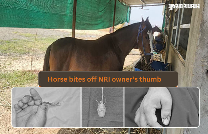 Horse bites off NRI owner’s thumb in Surat, doctors successfully reattach it