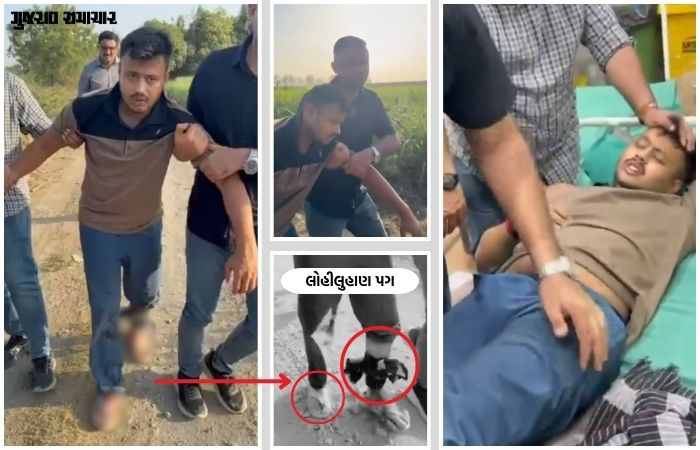 VIDEO| સુરત SBI બેંક લૂંટ કેસ: જાપ્તામાંથી ભાગવાનો પ્રયાસ કરનાર આરોપીને પોલીસે ગોળી મારી