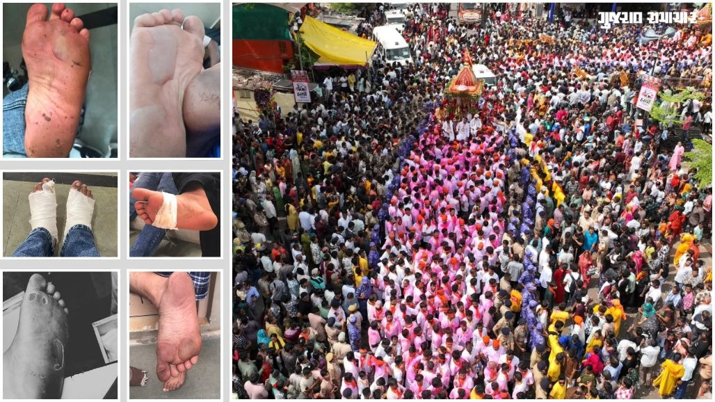 અમદાવાદ: રથયાત્રામાં ભક્તિ વચ્ચે ખલાસીઓની થઈ આકરી કસોટી, ગરમીથી રોડ પર પીગળેલા ડામરના કારણે પગમાં પડ્યા છાલા