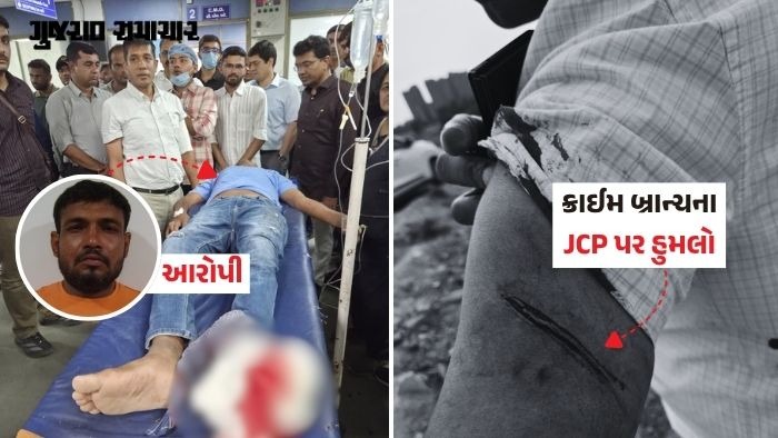 VIDEO: અમદાવાદમાં ક્રાઈમ બ્રાન્ચની ટીમ પર હુમલો, પૂછપરછમાં JCPને છરી મારી, આરોપીને પગમાં ગોળી ધરબાઈ