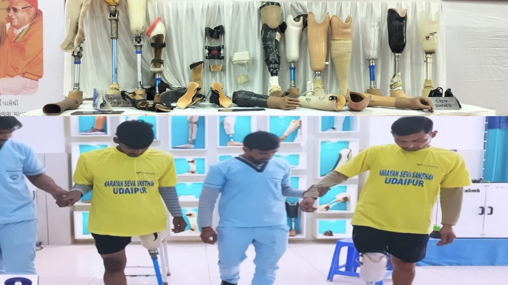 Technology, Hope and Second Chances: Free 3D Prosthetic Camp Brings New Possibilities to Hundreds in Ahmedabad