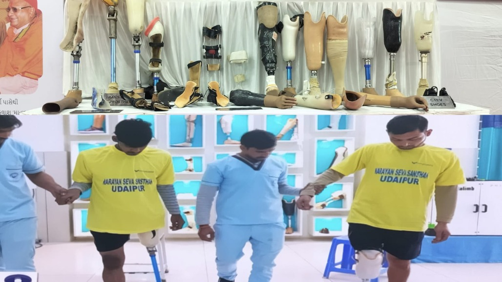 Technology, Hope and Second Chances: Free 3D Prosthetic Camp Brings New Possibilities to Hundreds in Ahmedabad