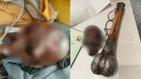 Delhi-Hyderabad Passenger Stopped At Airport With Suspected Monkey Skull In Hand Baggage Delhi-Hyderabad Passenger Stopped At Airport With Suspected Monkey Skull In Hand Baggage