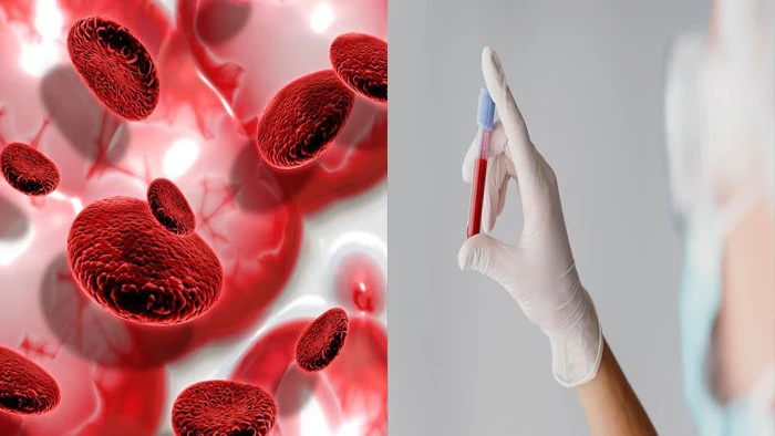 Gujarat Screens 83.68 Lakh People in Tribal Areas, Finds Over 30,500 Sickle Cell Patients