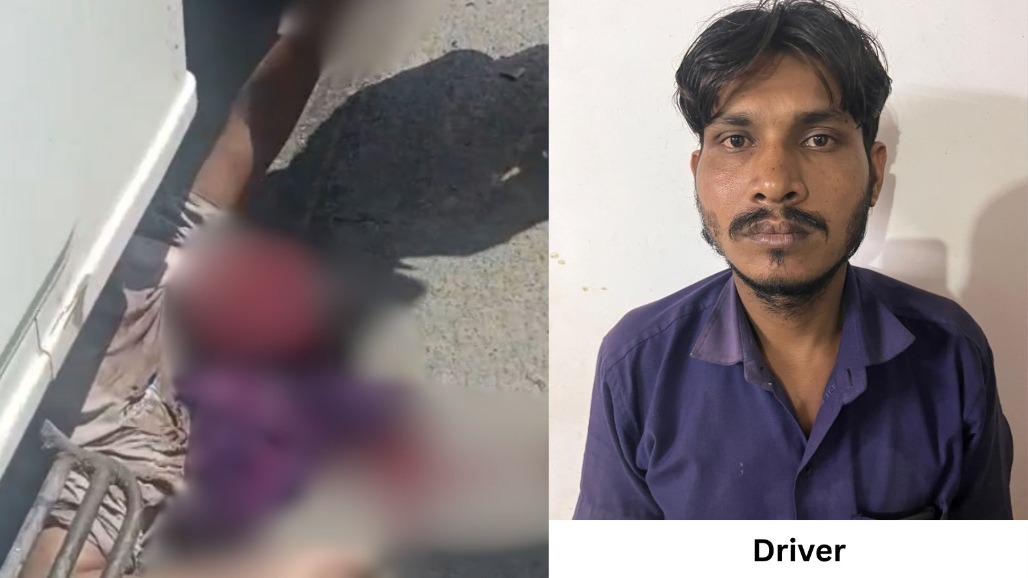 15-Year-Old Boy Suffers Severe Facial Injuries After Bolero Pickup Hits Him in Ahmedabad