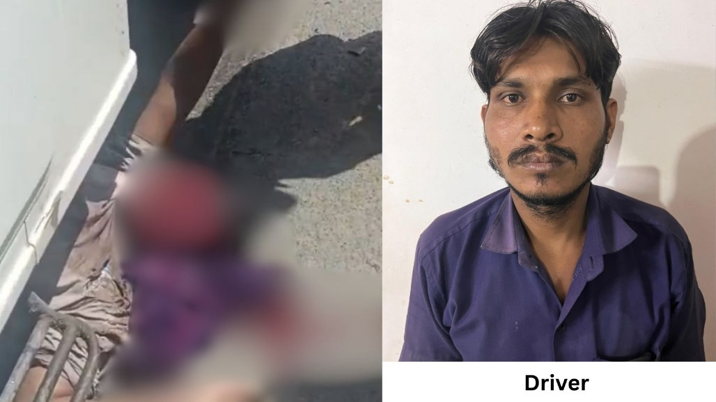 15-Year-Old Boy Suffers Severe Facial Injuries After Bolero Pickup Hits Him in Ahmedabad