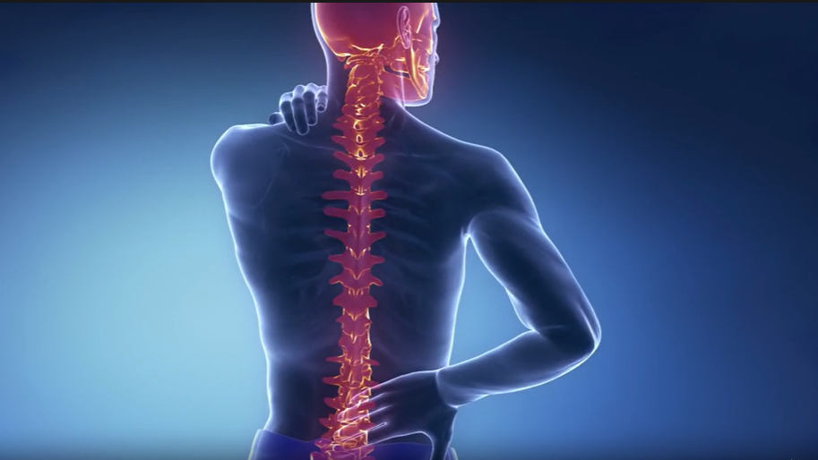 Spine-Related Issues Rise Among Youngsters in Ahmedabad, Cases Jump From 21% to 29% in Two Years